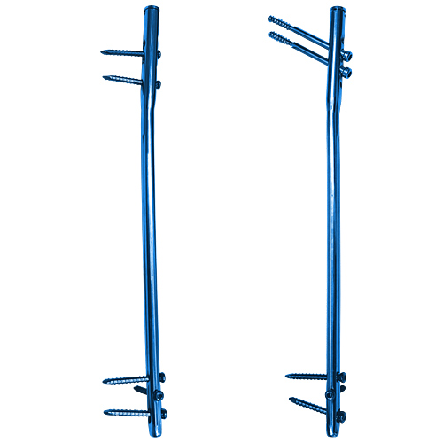 Clavo femoral multi-ángulo intra<em>HEAL</em>